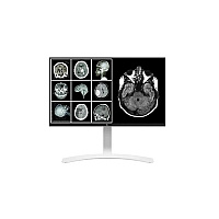 LG 27in Medical Ips 8mp Uhd 4k Clinical Monitor 3840x2160 Dp Fda Class I Taa (27HJ712CW)