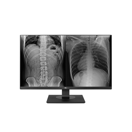 LG 27in Medical Ips 8mp Uhd 4k Clinical Monitor 3840x2160 Dicom Dp Fda Class I Taa (27HJ713CB)