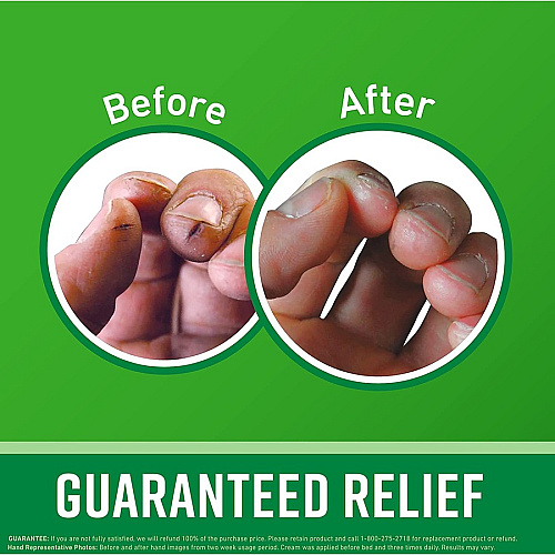 O'Keeffe's Working Hands Hand Cream Cream - 3.40 fl oz - For Dry Skin - Applicable on Hand - Cracked/Scaly Skin - Moisturising - 1 Each (K0350007)