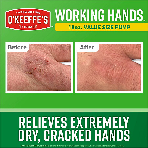 O'Keeffe's Working Hands Hand Cream Pump Cream - For Dry Skin - Applicable on Hand - Skin - Moisturising, Non-greasy, Unscented - 1 Each (116639)